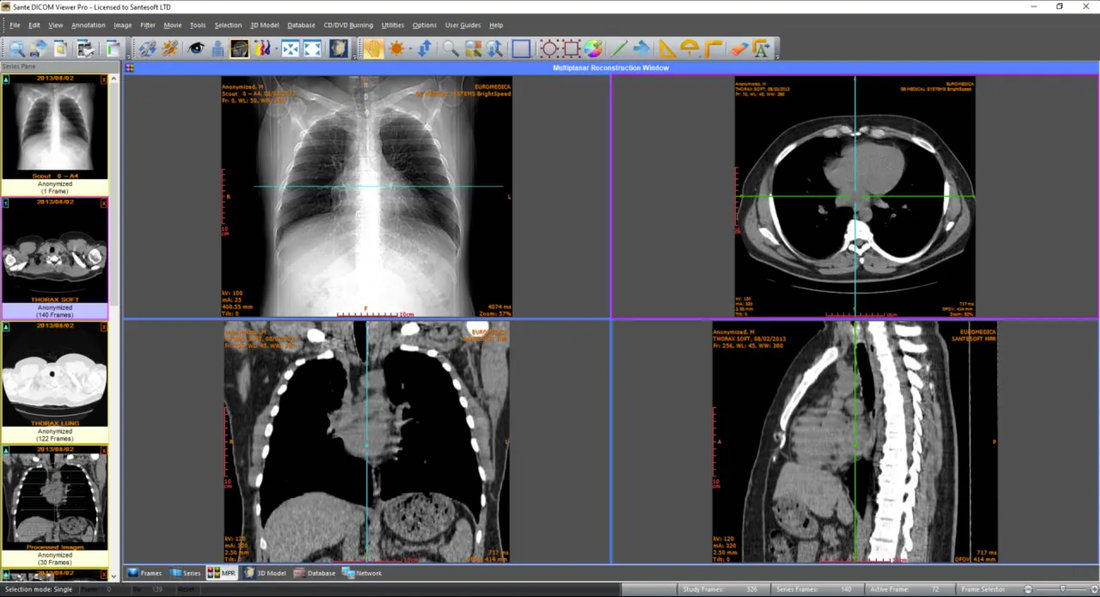 Sante DICOM Viewer Pro 14.0.2 注册版 - 医学图像浏览器